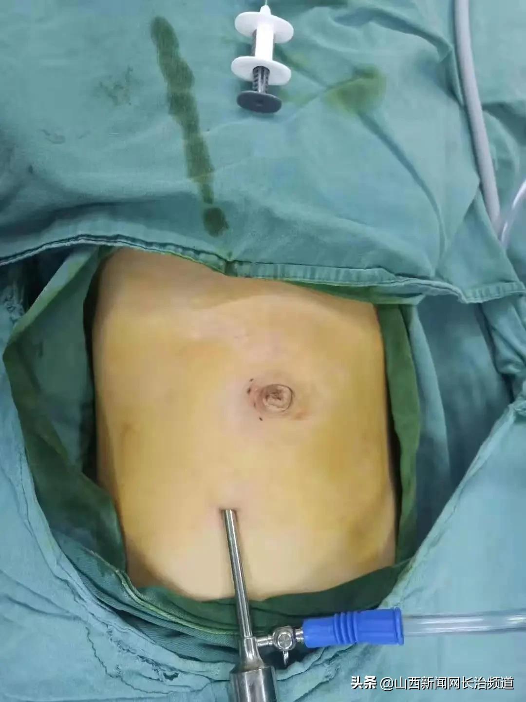 什么樣的疤痕不能當(dāng)兵？深入了解征兵體檢中的疤痕要求，征兵體檢中的疤痕要求，哪些疤痕影響入伍資格？