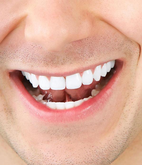 牙齒發(fā)黃變白小竅門，讓你的笑容更加自信璀璨，牙齒美白小竅門，重拾自信璀璨笑容的秘訣