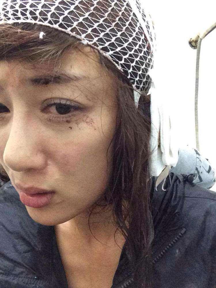 明星整容毀容最嚴(yán)重的是誰(shuí)，深度探討與反思，深度探討與反思，哪位明星整容遭遇最慘重的毀容？