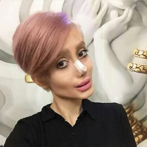 整容最瘋狂的女人，背后的故事與心理探索，整容狂熱背后的女人故事與心理揭秘