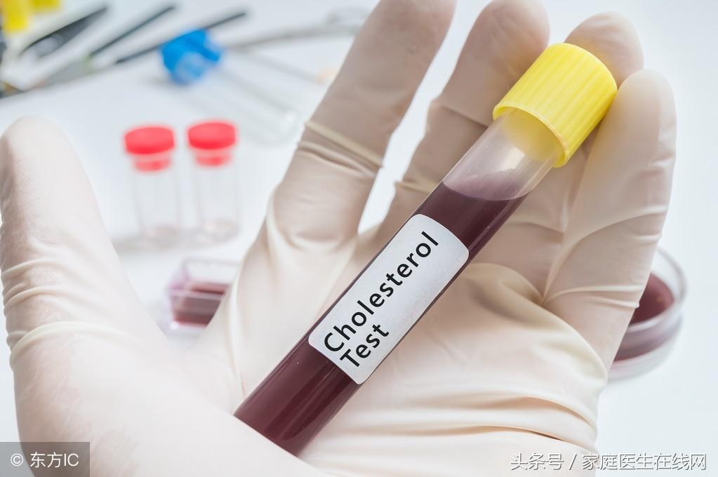 糖尿病的成因，深度解析其背后的原因，深度解析糖尿病成因，揭示背后原因真相